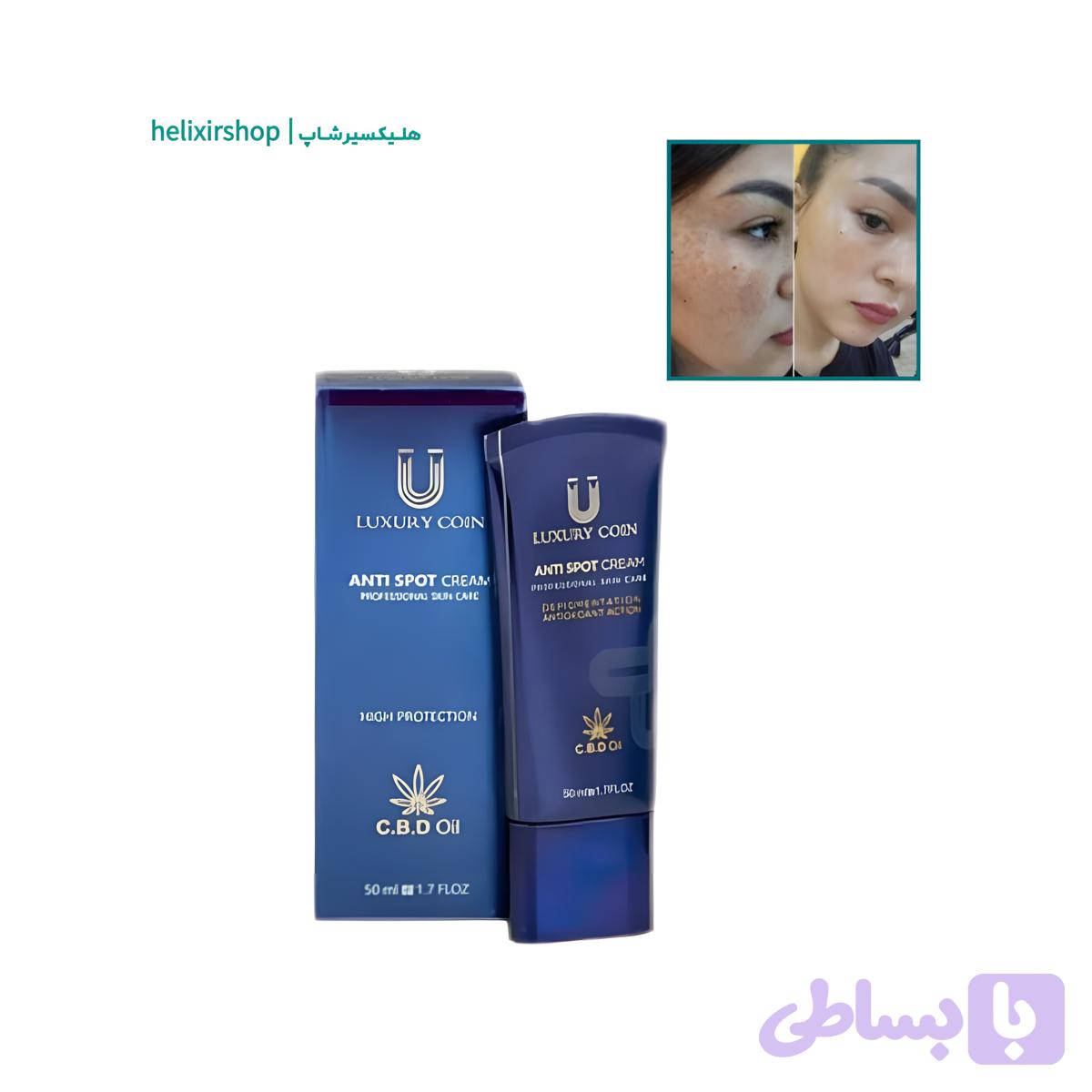 کرم بیوممتیک ضد لک قوی لاکچری کوین ۵۰ml | محو کننده لک‌های تیره، جای جوش و ملاسما