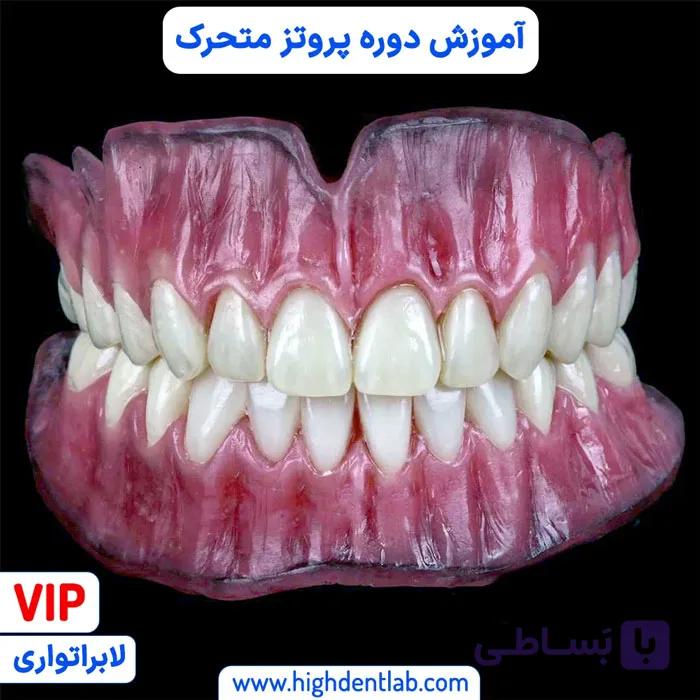 آموزش دوره پروتز متحرک — تصویر 1