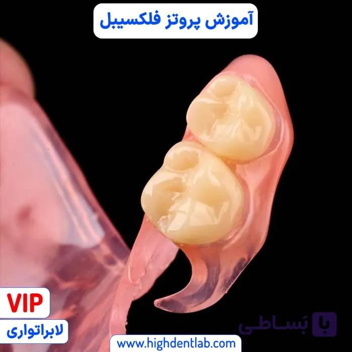 آموزش پروتز فلکسی — تصویر 1