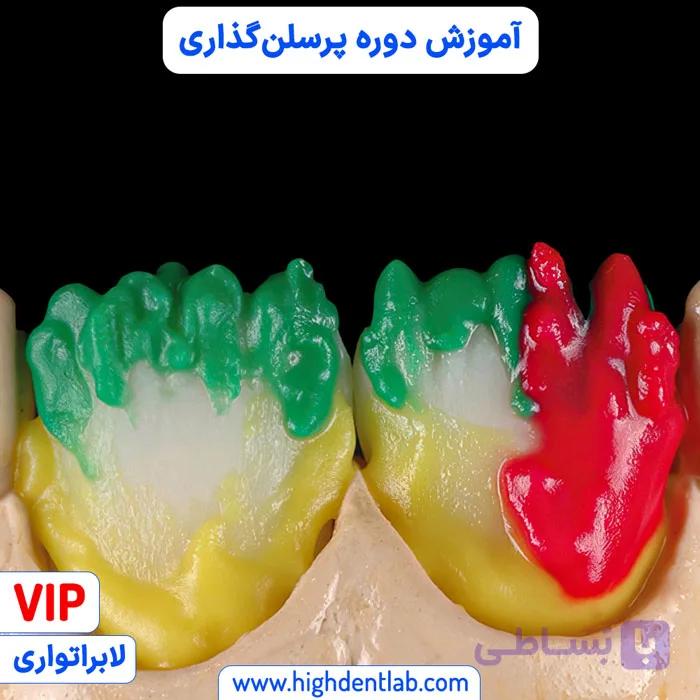 آموزش دوره پرسلن‌ گذاری — تصویر 1