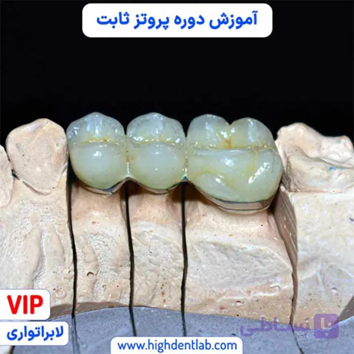 آموزش دوره پروتز ثابت — تصویر 1