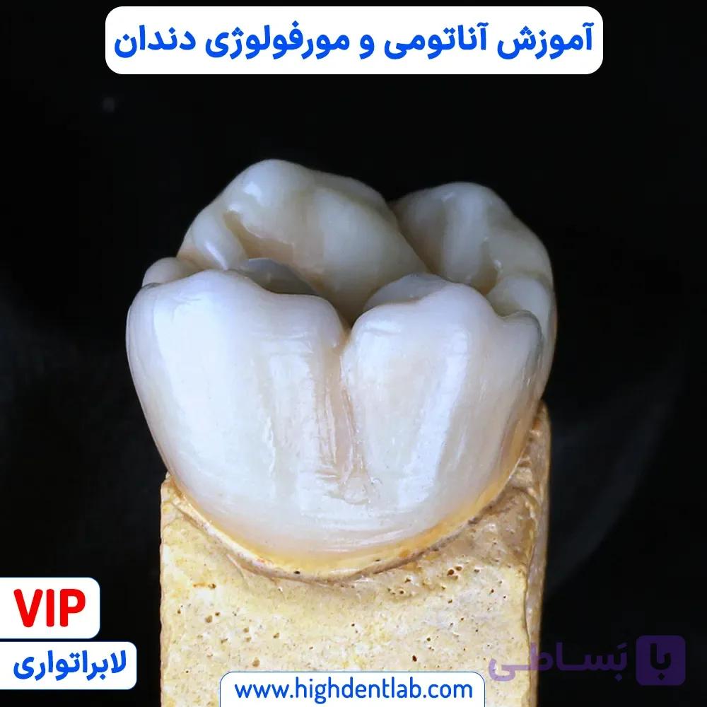 آموزش دوره آناتومی و مورفولوژی دندان — تصویر 1