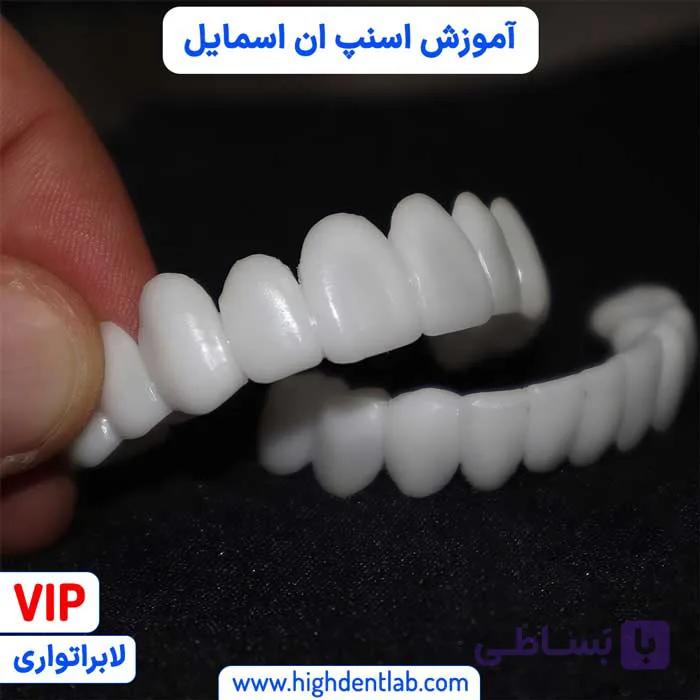 آموزش اسنپ ان اسمایل — تصویر 1