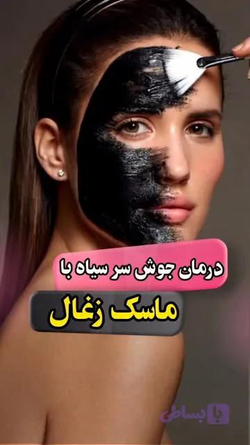 ماسک زغال (کد L7CKR)