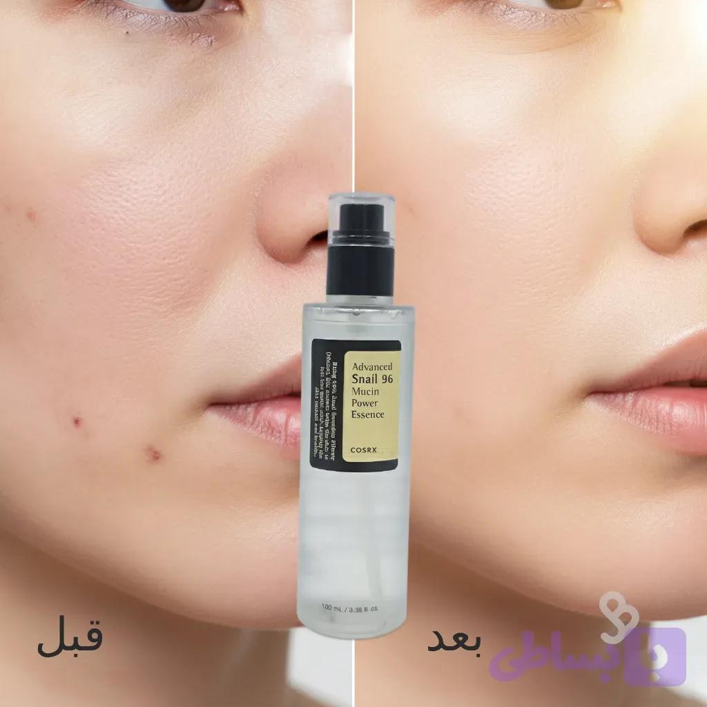 اسنس ترمیم کننده حلزون 96 کوزارکس | ترمیم پوست و محو کننده جوش