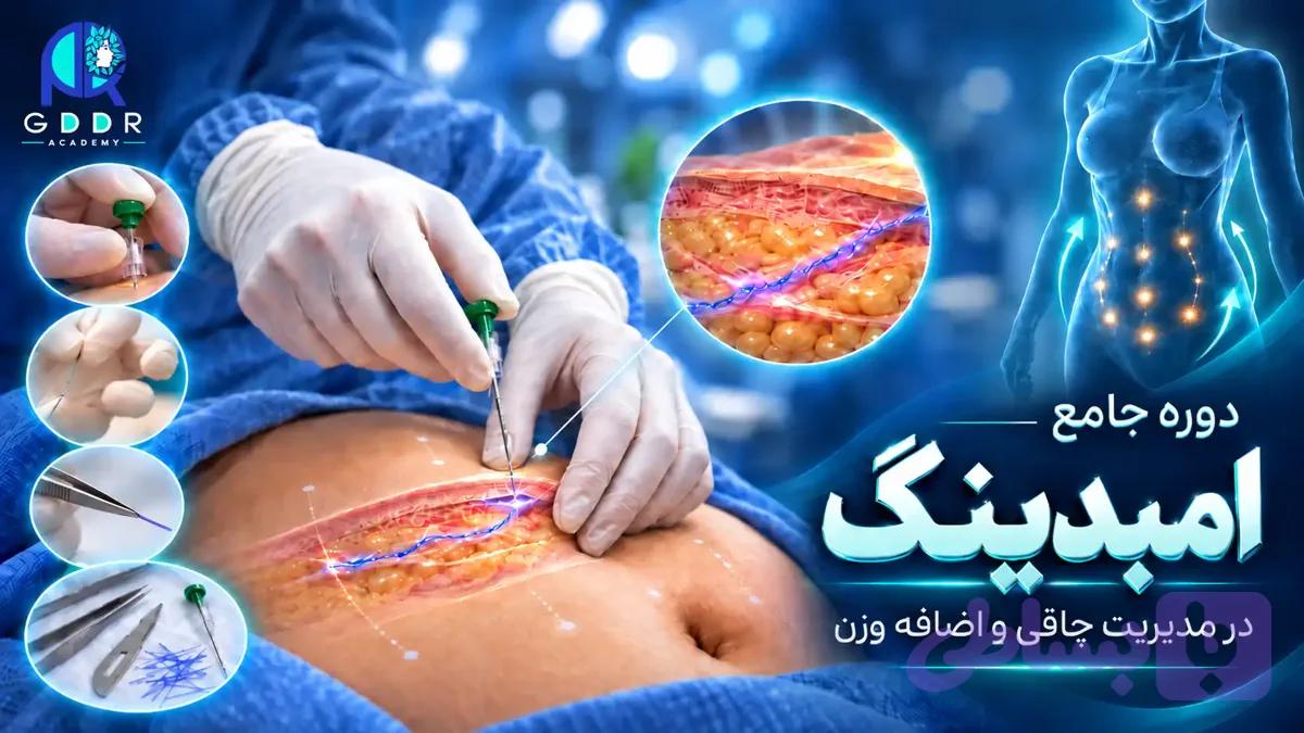 دوره آموزش امبدینگ در مدیریت چاقی