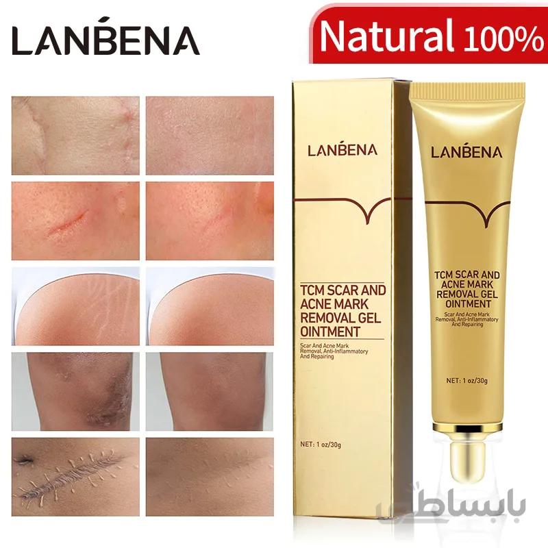 ژل کرم درمان جای جوش و اسکار لانبنا