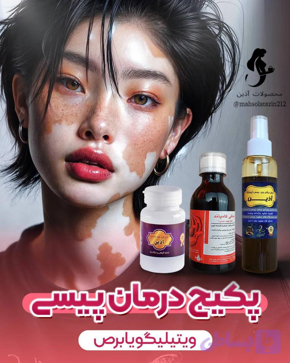 💓پکیج درمانی برص ، پیسی یا ویتیلیگو